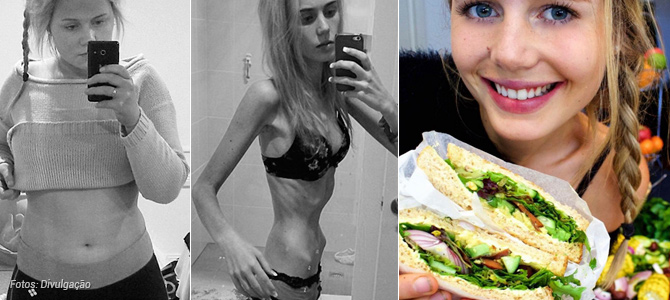 Jovem australiana supera anorexia e torna-se entusiasta de alimentos veganos e saudáveis